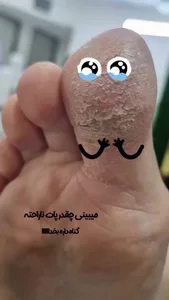 فشیال و پاکسازی بانو 2