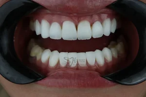 دندانپزشکی دکتر زکریا شیربیگی 4