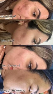 سالن پاکسازی پوست و فیشال تینا 2