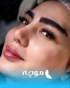 کلینیک زیبایی موچه 3