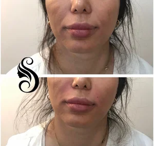کلینیک زیبایی ماهان رخ 5