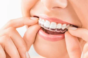 دندانپزشکی دکتر کامران امیر قلی