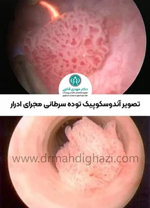 Dr Kamran Roudini - دکتر کامران رودینی فوق تخصص خون و سرطان