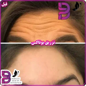 کلینیک زیبایی پارسیان بیوتی (پرشین بیوتی)