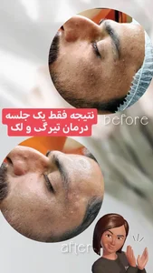 ماساژ، لاغری، پاکسازی پوست و مو (دلاژین) 2