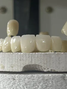 لابراتوار دندانسازی پارس دنت 🦷