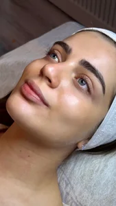 فیشیالیست (خدمات تخصصی پوست) هنگامه 3