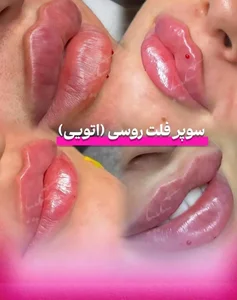 مجموعه پوست و مو زیبایی دلدار 3