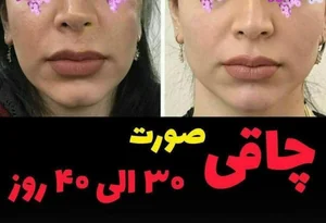 پودر جوانه گندم 2