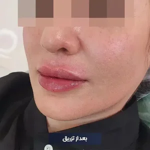 مرکز زیبایی دکتر طرزی 4