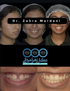 مطب تخصصی ارتودنسی دکتر زهرا مردانی