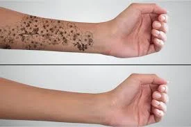 Tattoobax (تاتو بَکس)