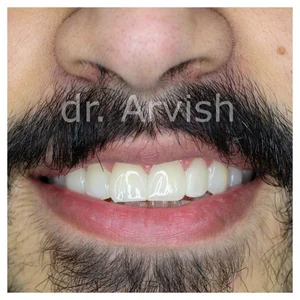 دندانپزشکی دکترآرویش