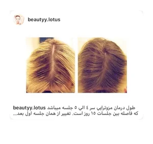کلینیک پوست و مو و لیزر نیلوفر آبی 2