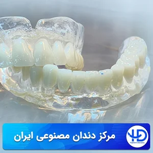 لابراتوار تخصصی دندانسازی ایرانیان (احمد ایران بان)