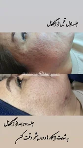مرکز فیشیال آرزو نظیفی 4