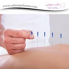 دکتر علی اعتمادی | طب سوزنی اصفهان | امبدینگ در اصفهان