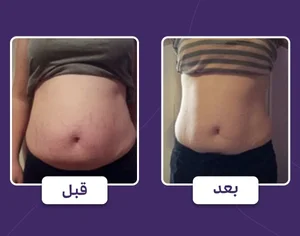 کلینیک لیزر و لاغری عصر زیبایی