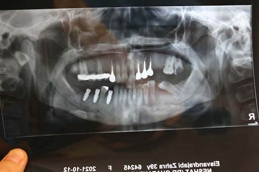 دکتر محمود زلکی زاده