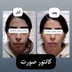 کلینیک لیزر و زیبایی راشا 4