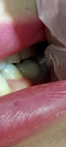 لابراتوار تخصصی دندانسازی داوود یوسفی