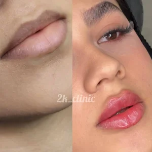 کلینیک زیبایی توکا 5