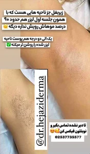 مرکز لیزر مو های زائد کندلا دکتر حجازی 2