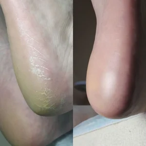 خدمات ناخن بیتا 2