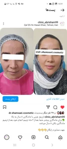 کلینیک زیبایی کاشت مو و ابرو ابریشم 5