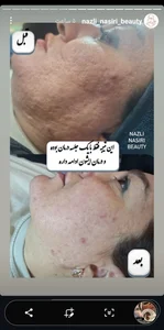 مرکز فیشیال آرزو نظیفی 5