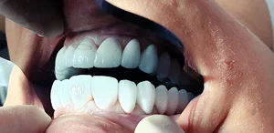 دندانپزشکی دکتر بهادر پارسا