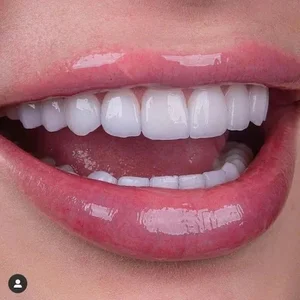 دندانپزشکی دنتالیوم