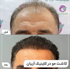 کلینیک بابل کاشت
