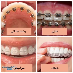 ست ارتودنسی