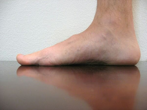 کلینیک ارتوپدی طب نادر