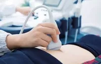 مرکز سونوگرافی ماهور