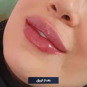 مرکز زیبایی دکتر طرزی 2