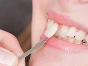 دندانپزشکی زیبایی دکترشجاعیفر