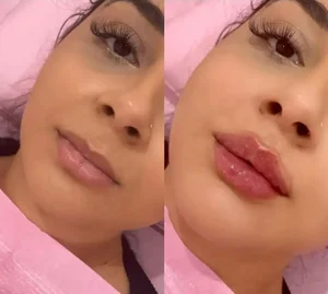 کلینیک تخصصی پوست،مو،زیبایی،لیزر لاولی 2