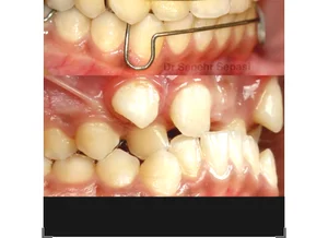 ارتودنسی اهواز دکتر سپهر سپاسی 2