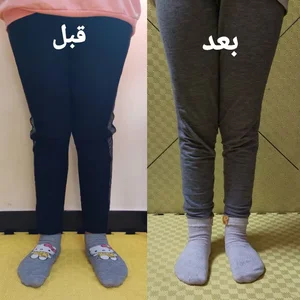 کلینیک ارتوپدی فنی پایش / اسکن پا / کفی طبی 3