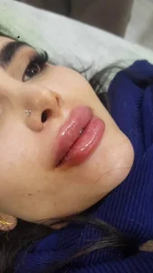 ستیلا با دکتر مریم هاشمی زنان و زایمان