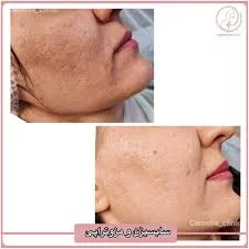 کلینیک زیبایی آرزو