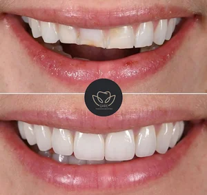 مطب دندانپزشکی دکتر حمزه زارع
