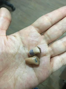 سمعک مهر آذین اهواز