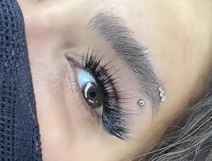 کاشت مژه کرمانشاه