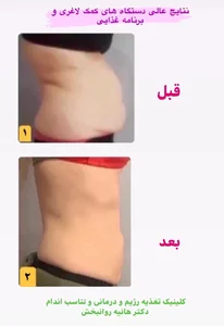 کارشناس تغدیه هانیه روانبخش 3