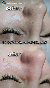 کلینیک زیبایی دلوین طهران 2