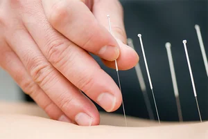 طب سوزنی دکتر محمد رضا معروفی