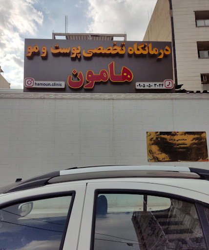 کاشت مو فرشته موسوی